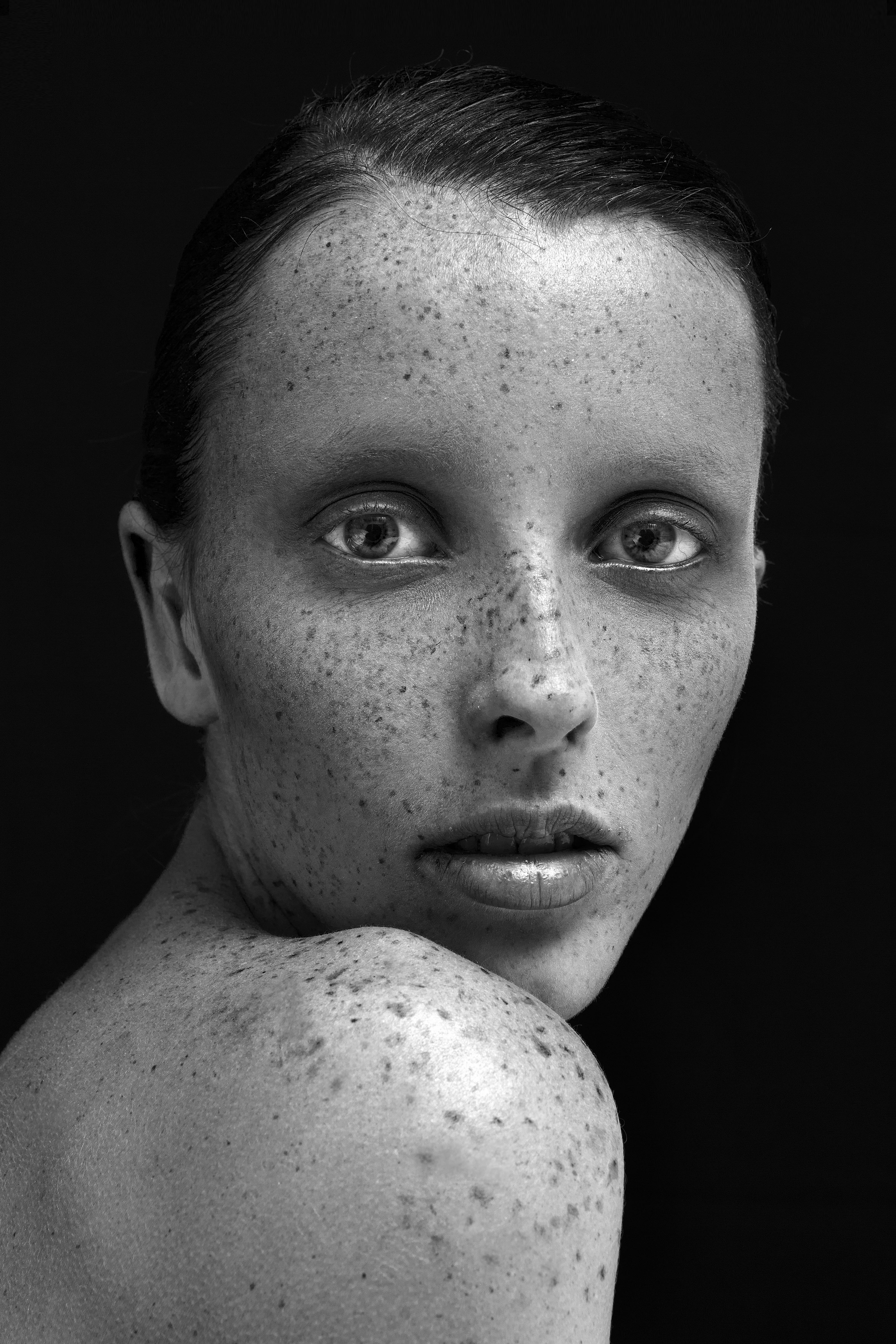 freckled-face-0